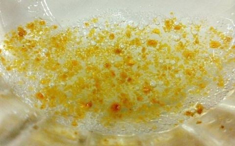 Xóa nếp nhăn bằng Vỏ Cam và Lòng Trắng Trứng