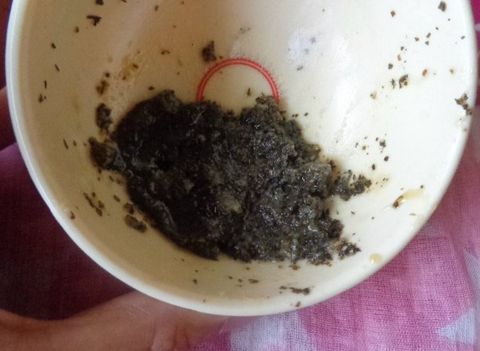 Cách trị sẹo thâm mụn bằng Trà Xanh