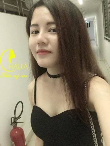 Khách hàng sau khi nâng mũi
