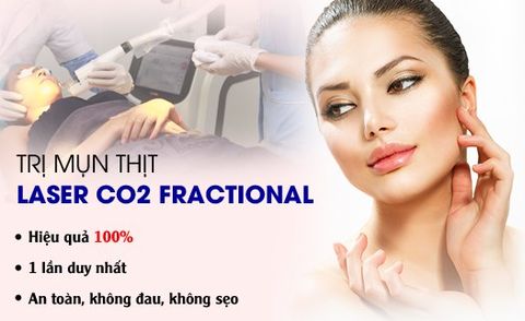 Laser CO2 điều trị mụn thịt trong 1 lần
