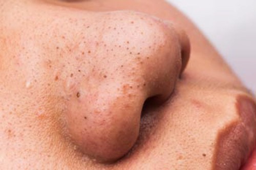 Con gái vụng về nhất cũng phải biết 5 mẹo làm đẹp này - Ảnh 5