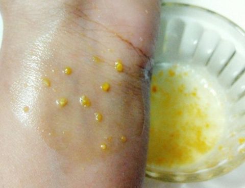 Xóa nếp nhăn bằng Vỏ Cam và Lòng Trắng Trứng