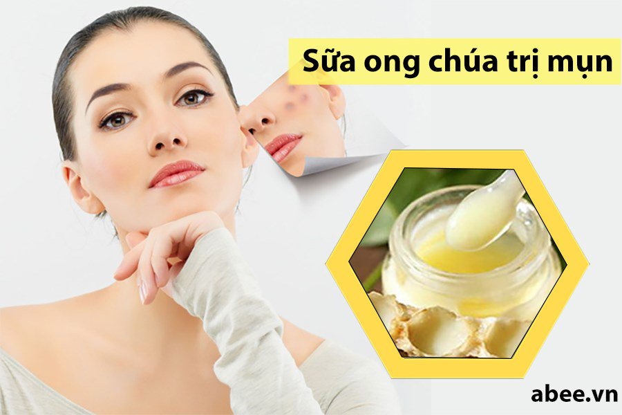 cach-su-dung-mat-na-sua-ong-chua-de-chua-tri-da-bi-noi-mun-hieu-qua