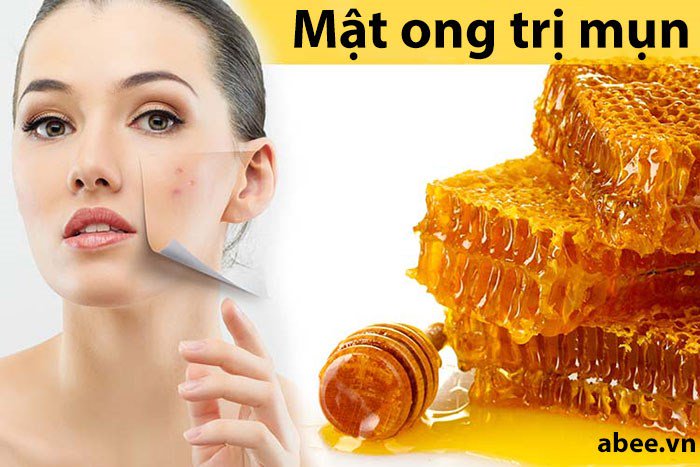 cach-su-dung-mat-na-mat-ong-chua-tri-mun-dung-cach-nhu-the-nao