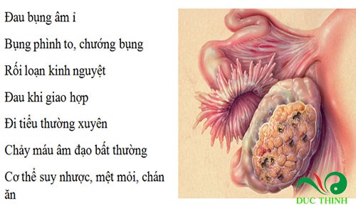 cay bim bip tri ung thu 2