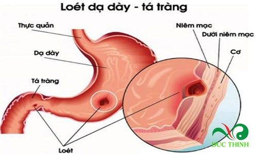 bat ngo truoc tac dung cua che day 1