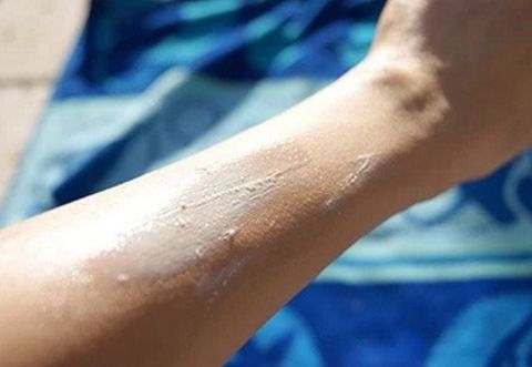 Cách làm kem chống nắng tại nhà