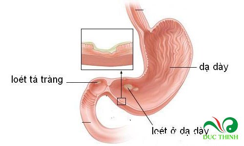 cach su dung che day hieu qua 1