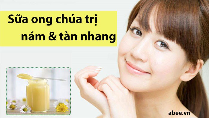 cach-chua-tri-nam-da-va-tan-nhang-don-gian-bang-mat-na-sua-ong-chua