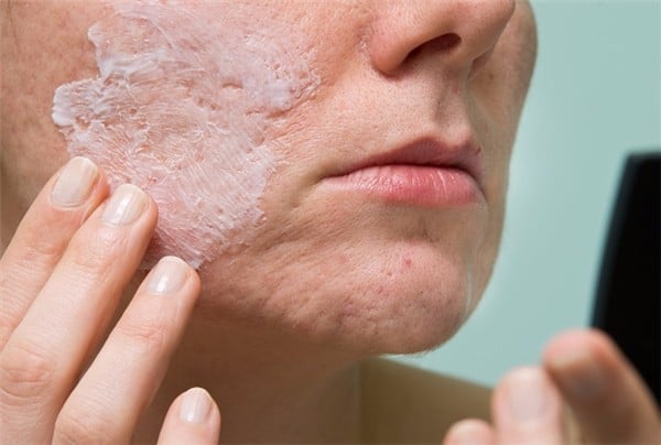 Hiểm họa khôn lường từ các mẹo làm đẹp “hot rần rần” trên mạng - Ảnh 1