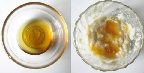 Điều trị nếp nhăn bằng Táo Xanh bạn đã thử chưa?