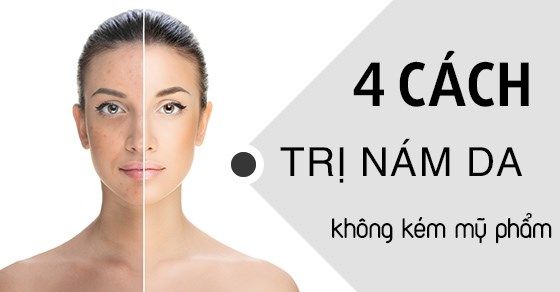 cách trị nám da hiệu quả