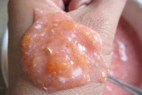 Trị mụn bằng quả mận bắc